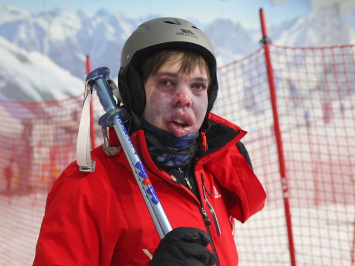 Snow Sports Foundation: George's Story